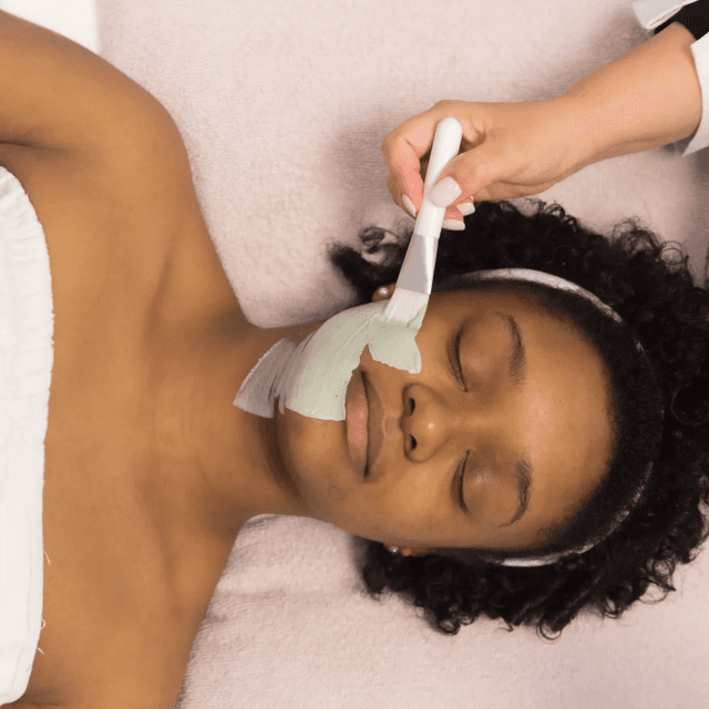 Skin Resurfacing Therapy at Esthetics By Cindy in Naples, FL